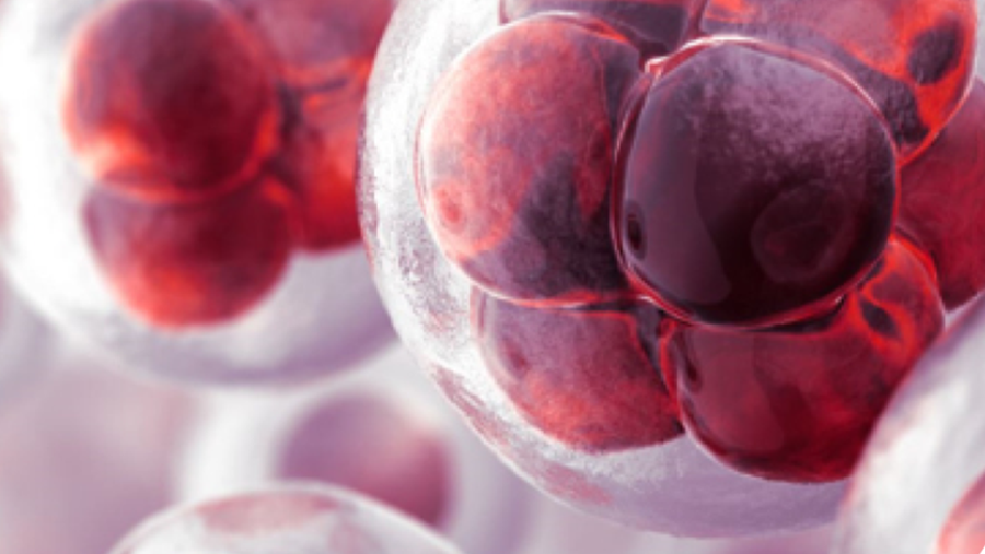 Sepsis: de grote onbekende